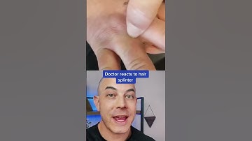 Thumbnail of Derm reacts to crazy hair splinter! #barber #hairsplinter #dermreacts #splinterremoval