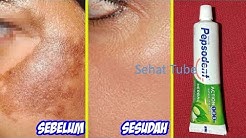CUKUP PAKAI INI, WAJAH MENJADI PUTIH DAN BEBAS FLEK HITAM SELAMA-LAMANYA || SEHAT TUBE - Durasi: 5.19. 