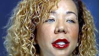 Famous Tiny Harris Has Foolish Eye Color Surgery Wealth