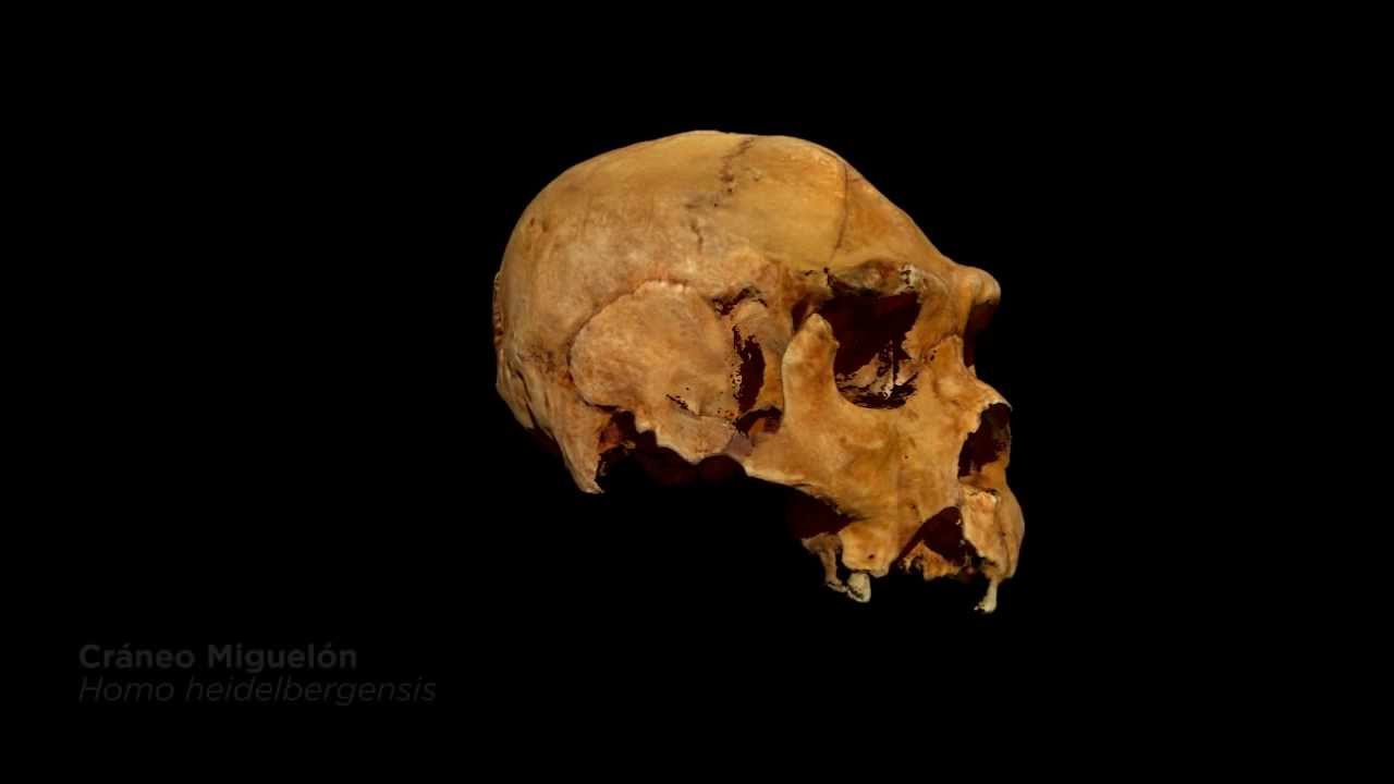Antropología y Prehistoria: Cráneo Miguelón - ArteHistoria craneofaringioma