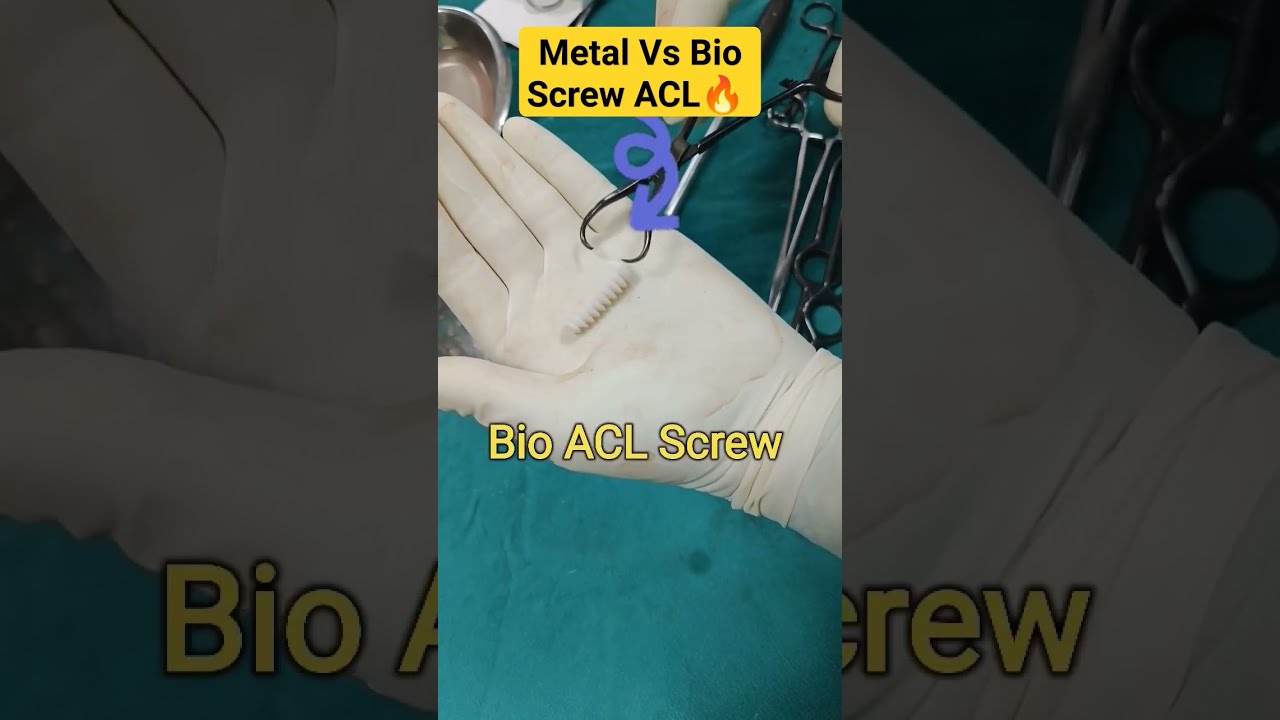 Metal ACL Vs Bio Screw Comparison 