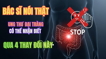 Bác Sĩ Cảnh Báo: 4 Dấu Hiệu Ung Thư Đại Tràng Nhiều Người Bỏ Qua!