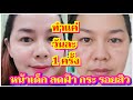 ทำแค่วันละ 1 ครั้ง ลดอายุผิว 10 ปี ผิวใสไร้สิว ไร้ฝ้า กระ จุดด่างดำ |แม่นายมาแชร์