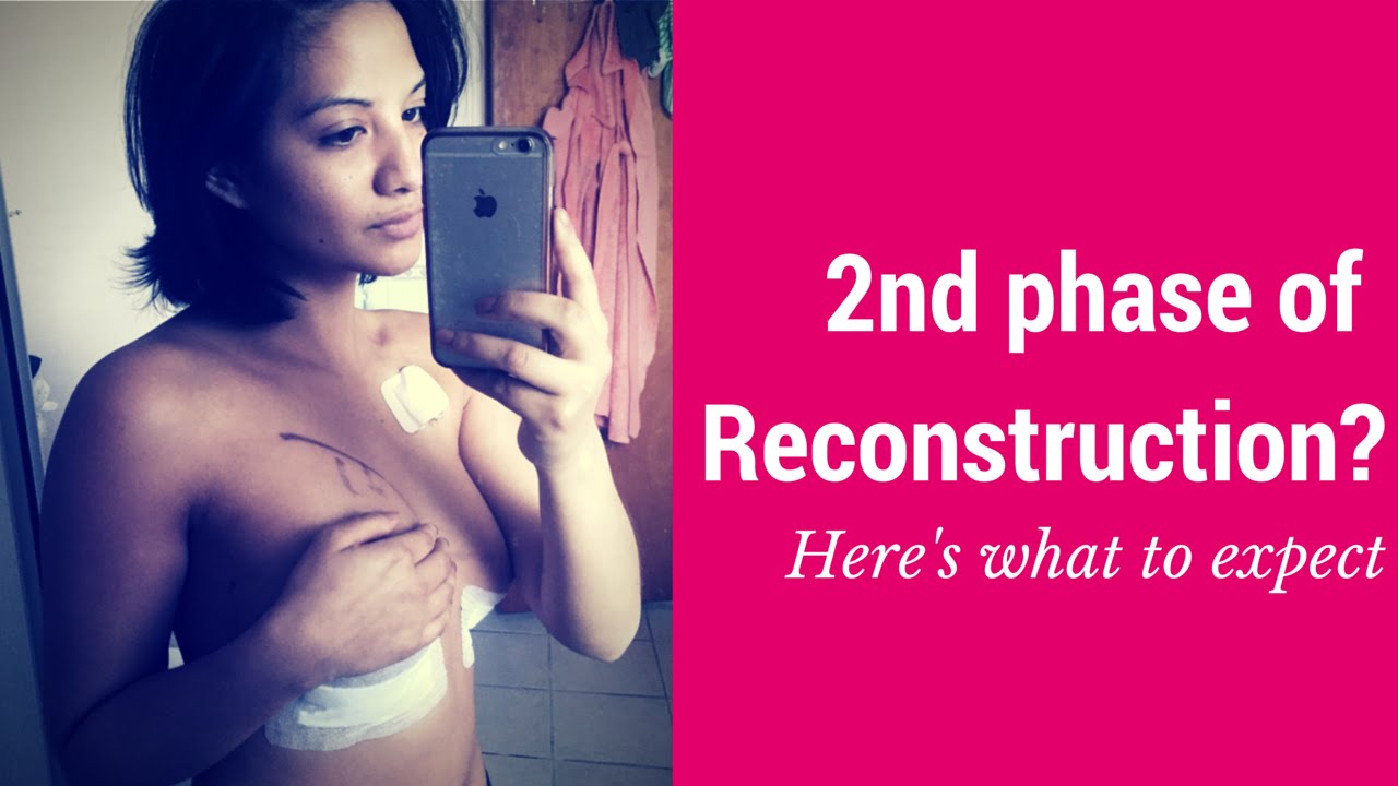 breast cancer reconstructions Man boob cures