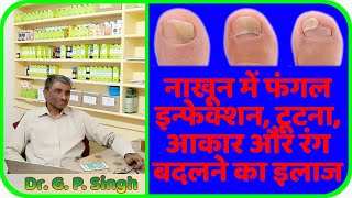 Nail Fungal Infection Treatment | Homeopathic Medicine For Nail Fungal Infection Fully Explained !