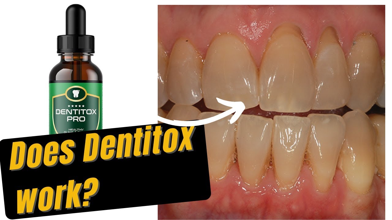DENTITOX REVIEW – DENTITOX PRO { THIS IS WHY YOU SHOULD GET DENTITOX PRO}