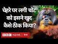 Wild orangutan: इस ओरांगुटान ने ख़ुद ठीक कर ली अपने चेहरे पर लगी चोट (BBC Hindi)