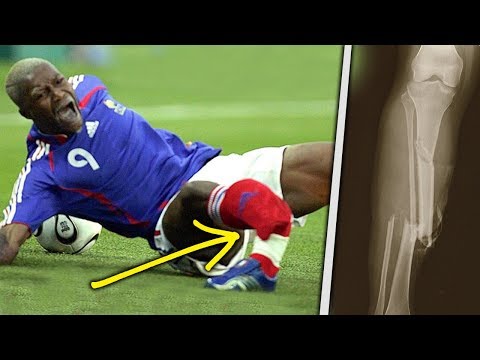 10 Horrific Injuries That RUINED The World Cup!