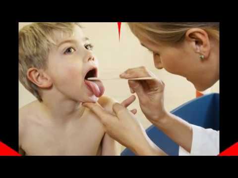 ანგინის სამკურნალო რეცეპტები