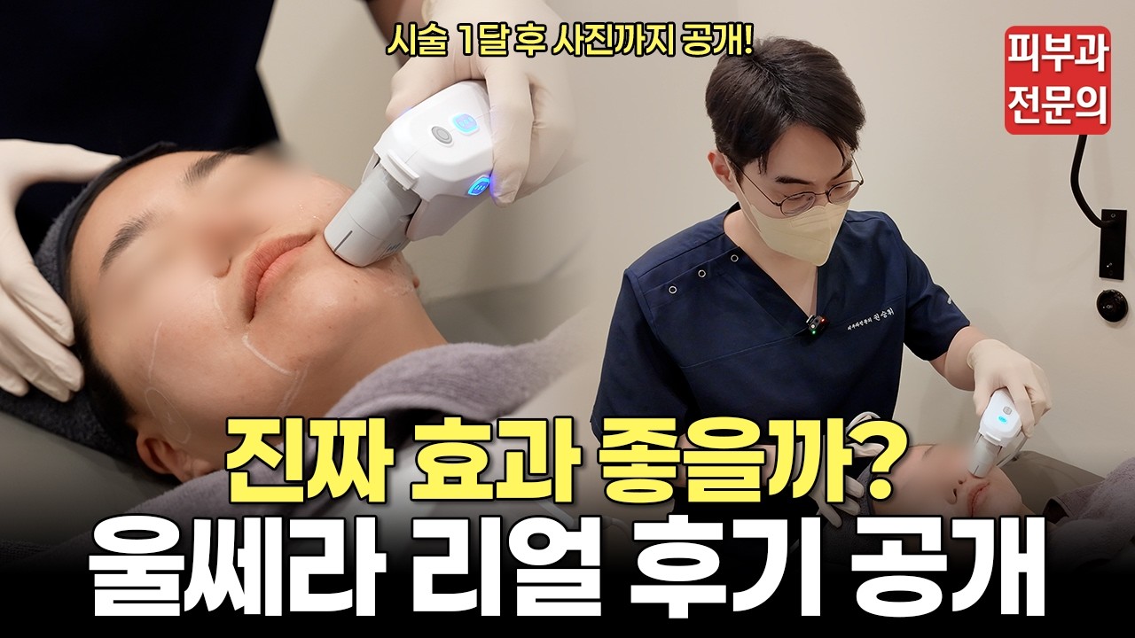 울쎄라 리얼 후기 공개! (feat. 써마지 비교, 통증)ㅣ울쎄라 후기, 울쎄라 써마지, 울쎄라 통증, 울쎄라 전후, 마곡 피부과, 마곡나루 피부과, 강서구 피부과, 마곡 울쎄라