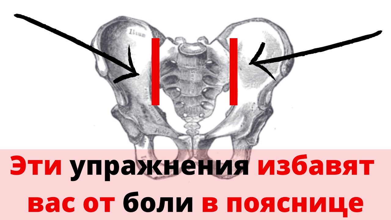 упражнения при болях в подвздошно крестцовом суставе. крестцово подвздошный сустав упражнения. гимнастика для крестцово подвздошного сочленения. артроз подвздошно-крестцовых сочленений лфк. упражнения для крестцово-подвздошного сустава.