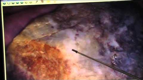 Fascia creates Perfectly Preserved Soft Tissue mudfossils