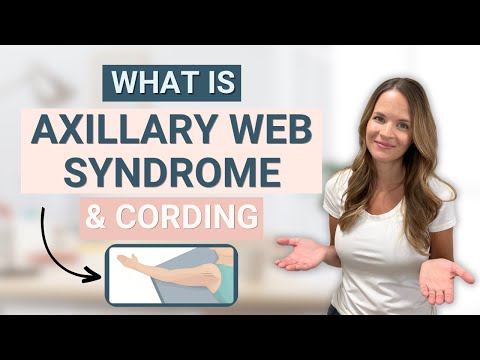 3 Things to Improve Axillary Web Syndrome