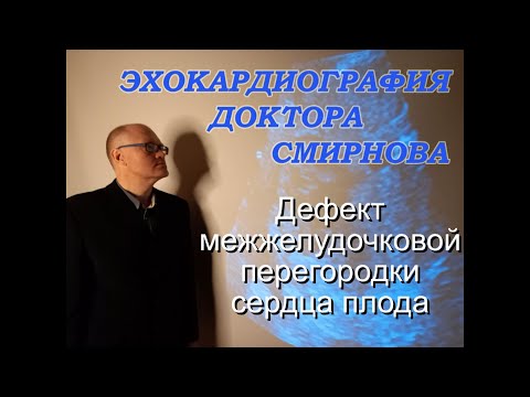 11. Дефект межжелудочковой перегородки у плода (Ventricular Septal Defect in fetus)