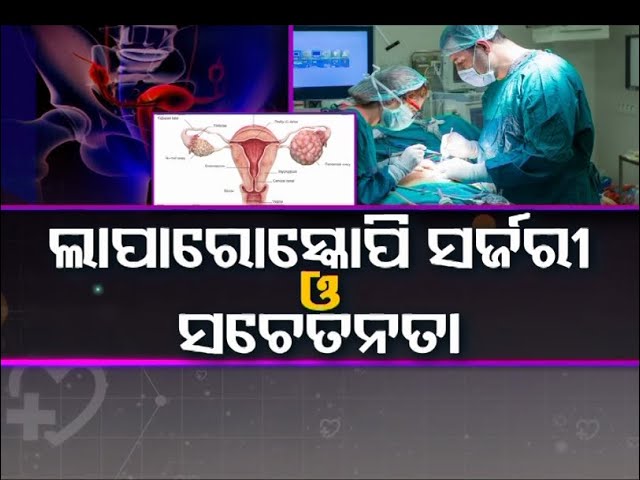 Doctor Doctor | Laparoscopy: Purpose, Preparation, Procedure