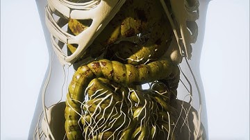 The 𝗚𝘂𝘁-𝗕𝗿𝗮𝗶𝗻 𝗔𝘅𝗶𝘀 in Brain Disorders 🧠