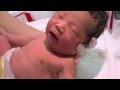 【生まれたて】生後1時間の赤ちゃん-毛むくじゃらな背中