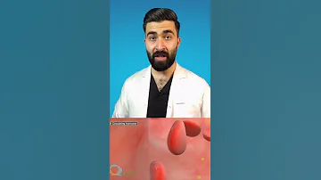 هل يوجد طريقة لزيادة الطول 