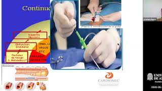 Utilidad en la Practica Clínica del Estudio de Biomecánica Vascular - Dr. Cristian Gabriel Ponce screenshot 3