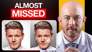Doctor Reacts to Gordon Ramsay's Skin Cancer Treatment Profile