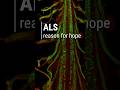 Breakthrough could lead to an ALS cure