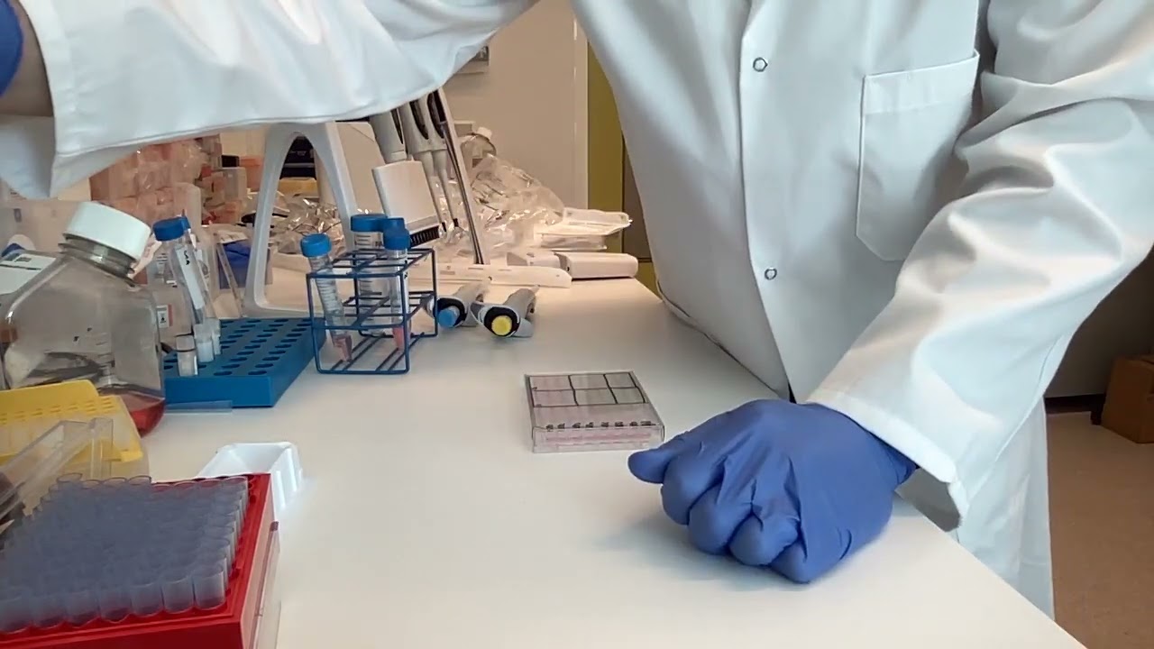 Preparing the spiked samples for the Monocyte Activation Test (MAT)