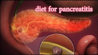 dietary rules for pancreatitis screenshot 5
