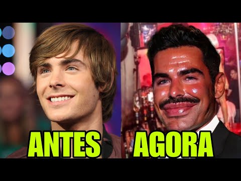The Accident That Disfigured Zac Efron and Made Hollywood Turn Its Back