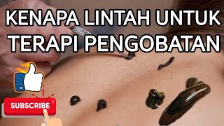 KENAPA TERAPI LINTAH UNTUK PENGOBATAN - Jovart Channel