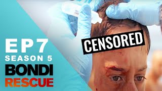 Boy Gets MASSIVE Gash After Falling | Bondi Rescue  Season 5 Episode 7 (OFFICIAL UPLOAD)