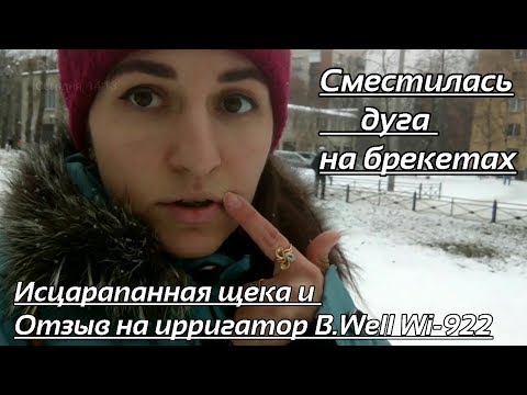 Сместилась дуга на брекетах/Исцарапанная щека и Отзыв на ирригатор B.Well Wi-922