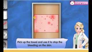 Snow Hospital - Skin Grafting - Operation Game screenshot 4