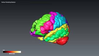 Brain Selection