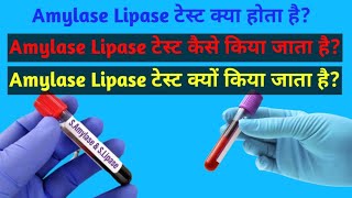 Amylase Lipase test || Amylase Lipase टेस्ट क्या होता है || क्यूं किया जाता है जाने एक ही वीडियो