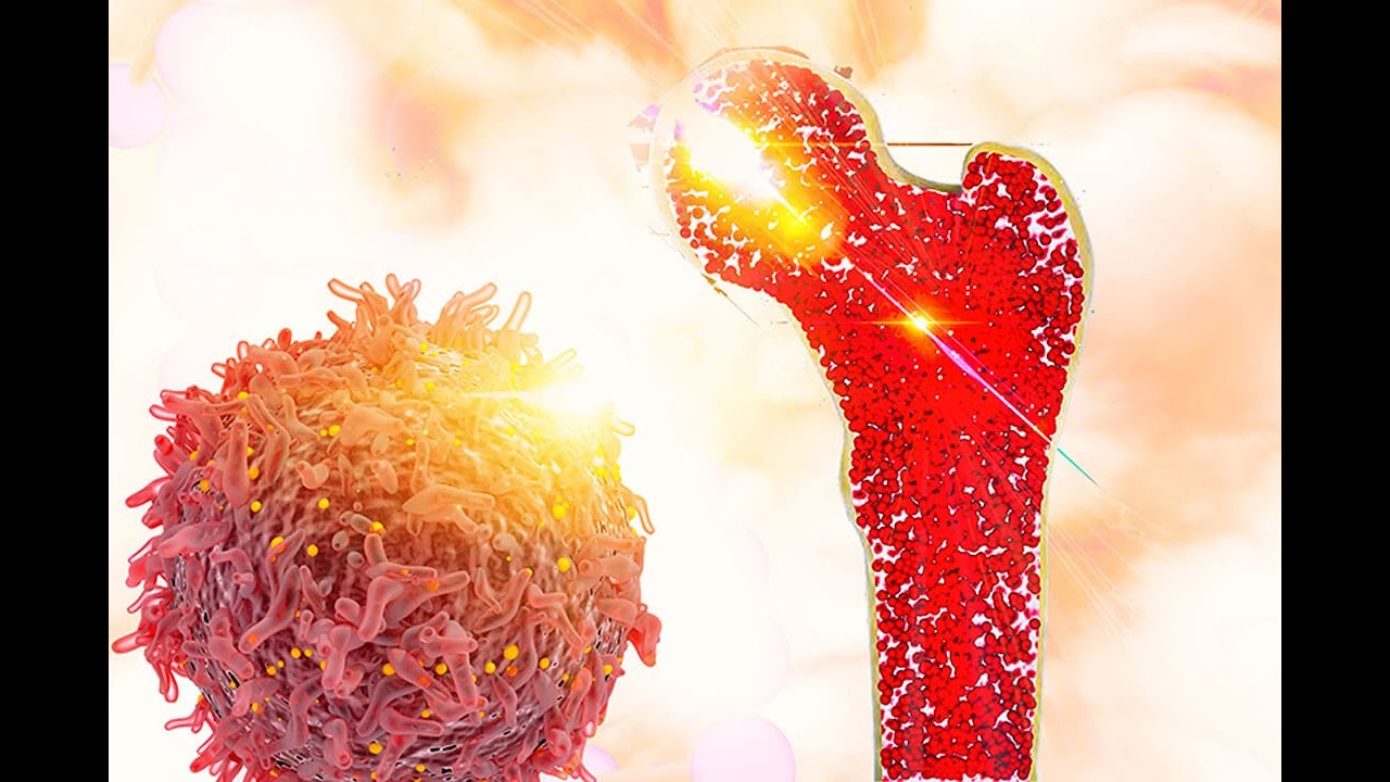 مقابلة مع د.محسن الزهراني - التبرع بالخلايا الجذعية