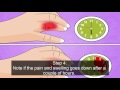 treatment of a broken finger, how to treat a broken finger