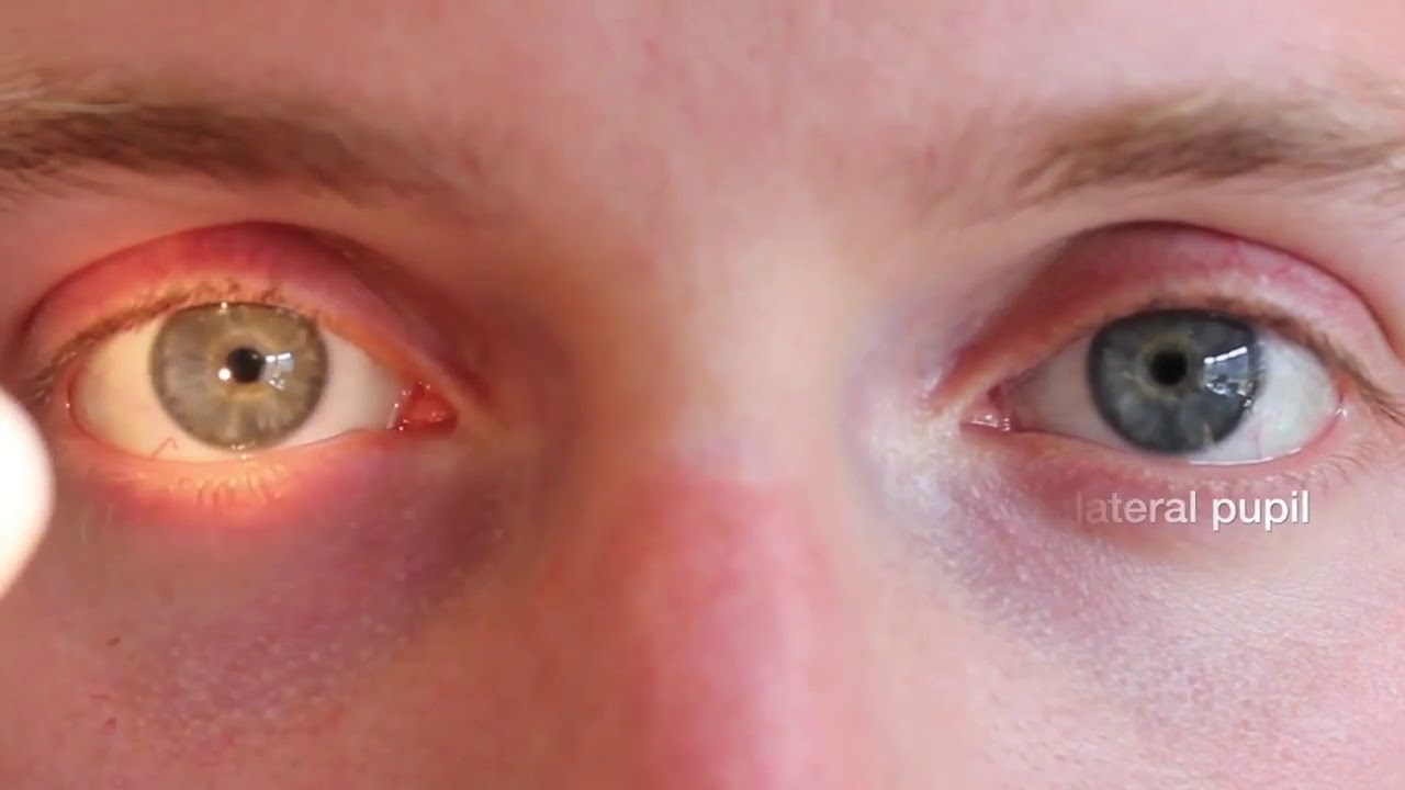 pupil examination YouTube