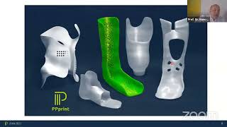 3D Printing for Prosthetics
