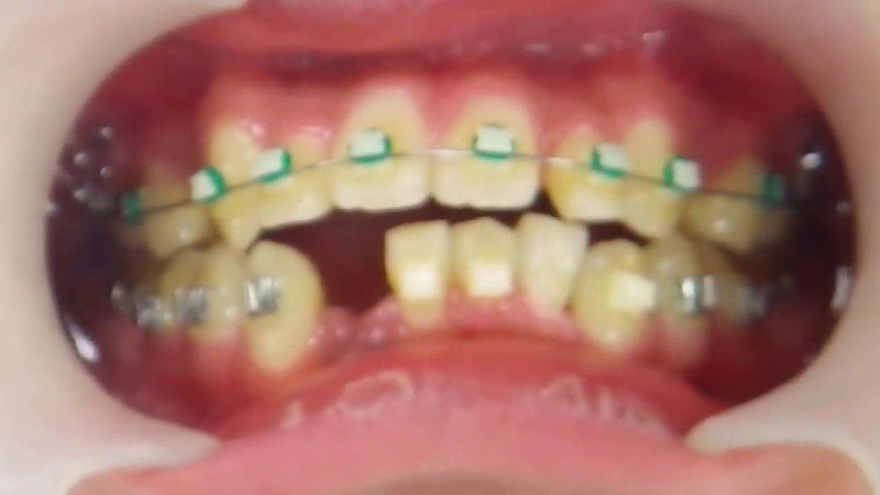 maxresdefault.jpg