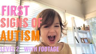 Part 2: Early signs of Autism  Toddler 12 years  Real Footage  Level 2 Autistic Baby First Signs