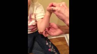 Nursemaid's Elbow Reduction Procedure