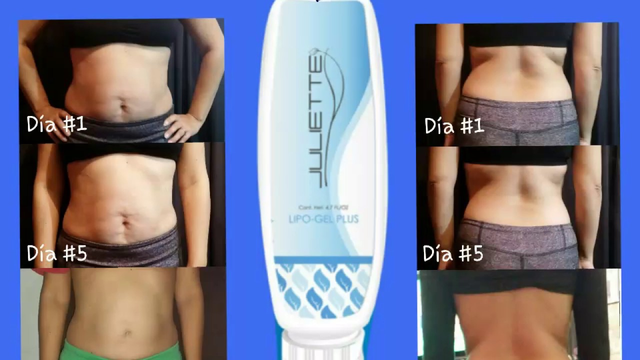 Lipo-Gel Plus/cambios en tan solo 9 aplicaciones camera iphone 8 plus apk