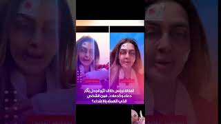 نرجس حلاق تثير الجدل بآثار دماء وكدمات.. فمن الشخص الذي اتهمته بالاعتدا.ء؟
