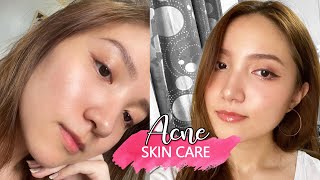 【BEAUTY】Skin care products haul | How I Cleared My Oily Skin | Korean Skin Care Philippines