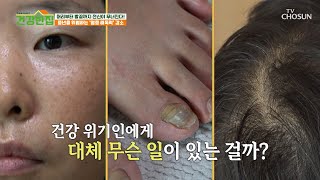 떨어진 염증 해독력으로 급격한 노화를 겪고 있는 그녀😥 TV CHOSUN 240528 방송 | [건강한 집2] 20회 | TV조선