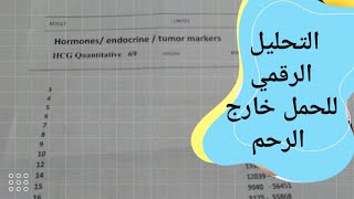 التحليل الرقمي للحمل خارج الرحم