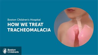 How we treat tracheomalacia | Boston Children's Hospital