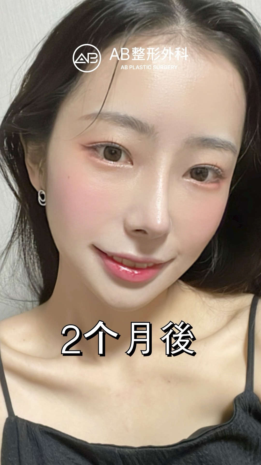 三項整形一次完成！路人臉變韓系仙女 #shorts