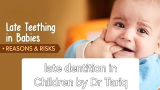 Approach to delayed dentition in Children  Late Teething in Babies-Know the Causes and Complications
