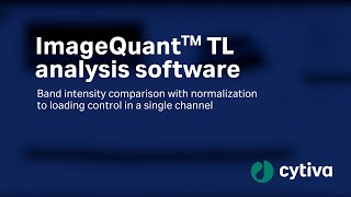 ImageQuant™ analysis software - Band intensity comparison to loading control Wealth